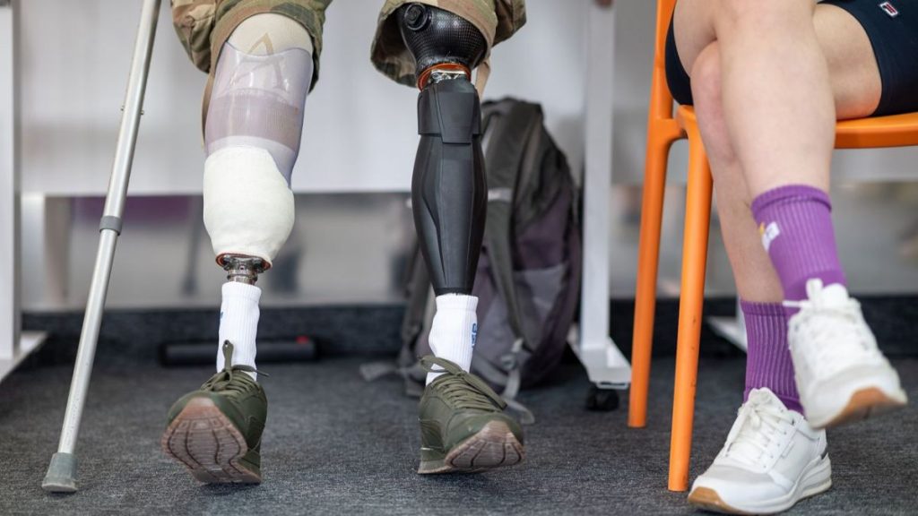 Військові зможуть отримувати деякі види протезів швидше